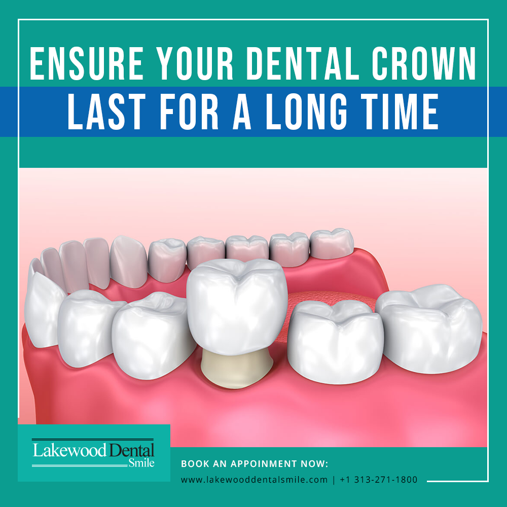 Ensure your dental crown last for a long time - Lakewood Dental Smile